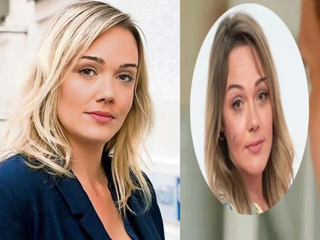 alwara höfels narbe